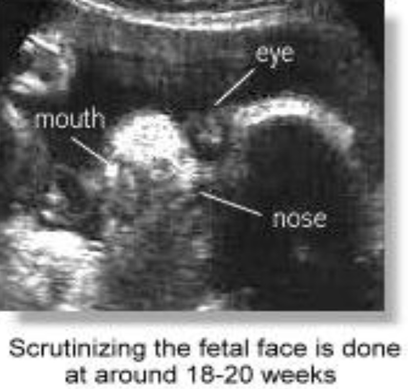 Fetal image