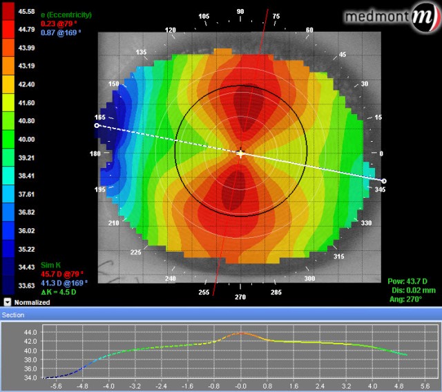 Topography 1.6 Wtr 4.50dp L2L